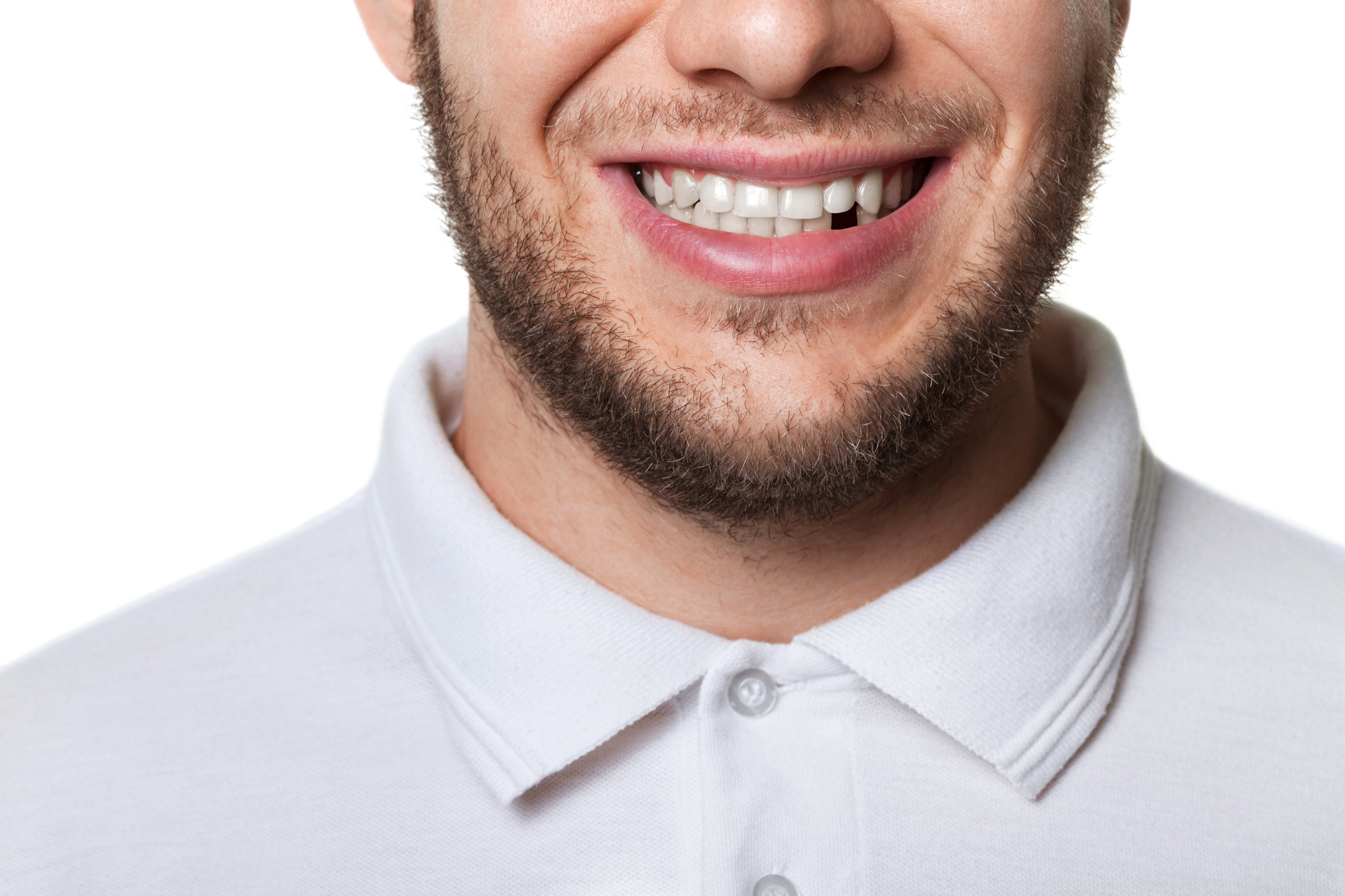 Implants Imperial Dental