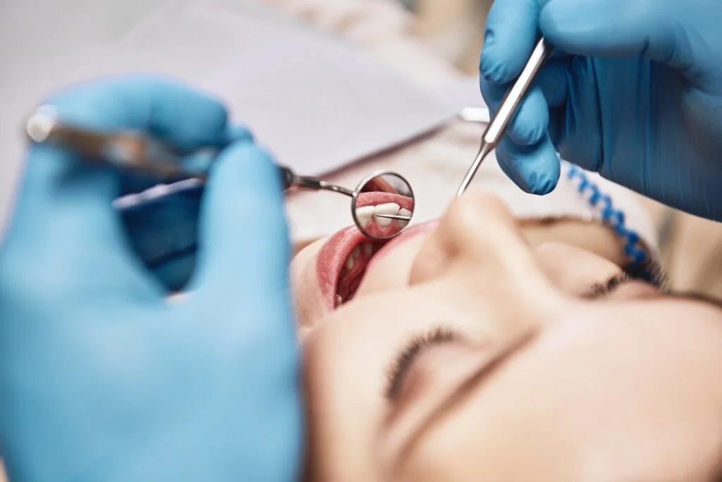 cracked teeth-fractured cusp-craze lines-root canal