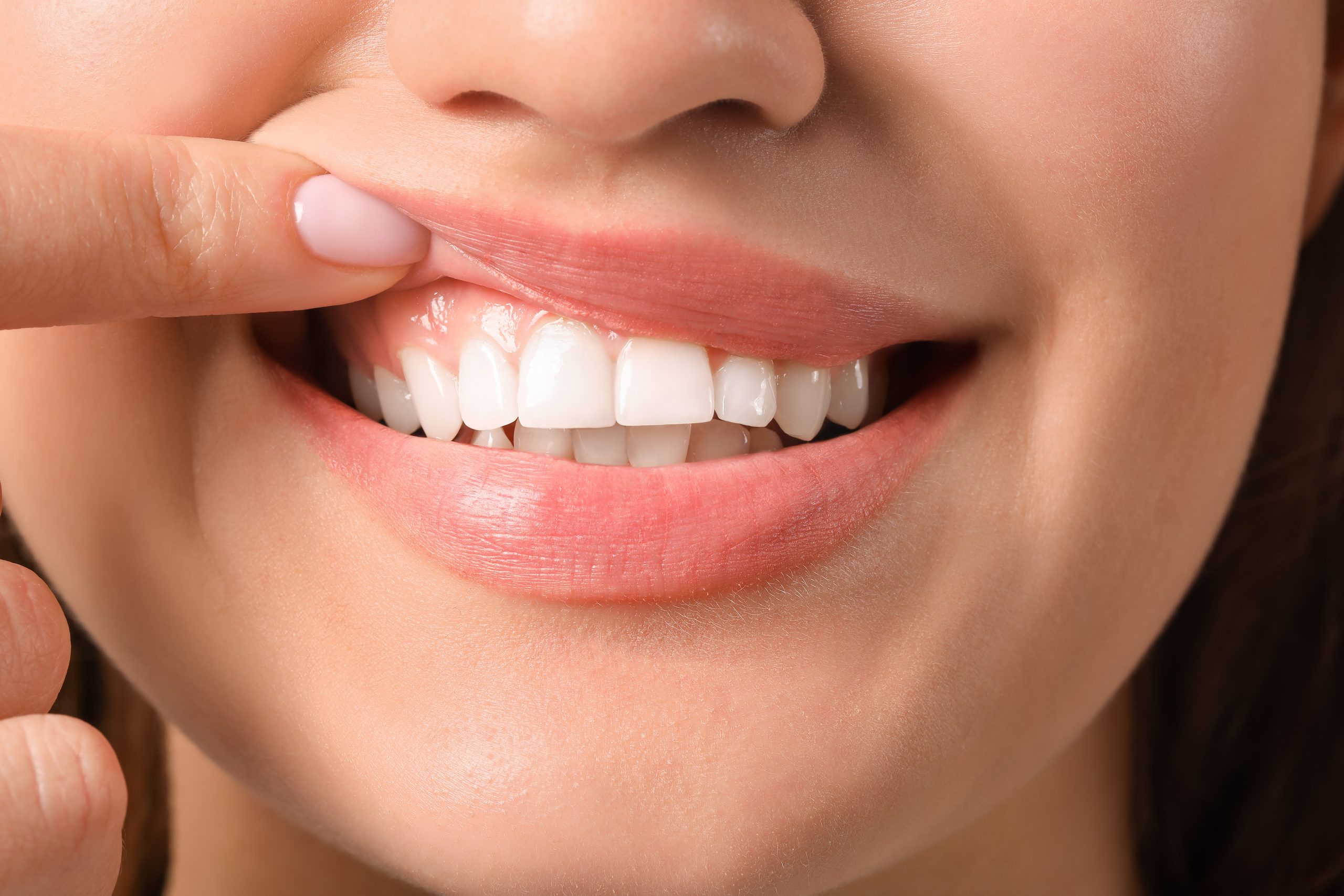 Woman showing healthy pink gums for National Gum Care Month, Imperial Dental Center, Sugar Land
